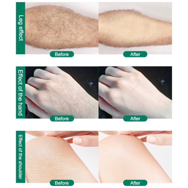 CJEER Upgraded Crystal Hair Removal Magic Crystal Hair Eraser For Women And Men Physical Exfoliating Tool Painless Hair Eraser Removal Tool For Legs Back Arms - Image 11