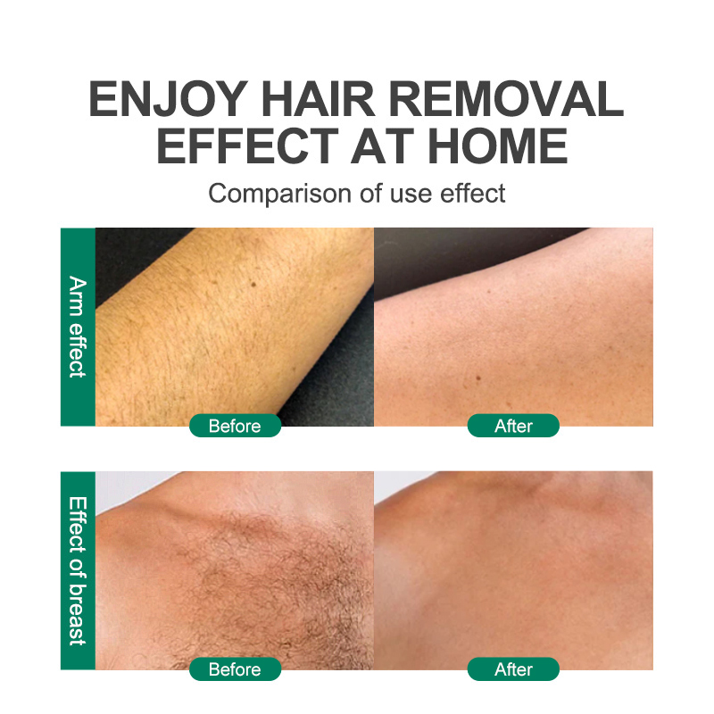 CJEER Upgraded Crystal Hair Removal Magic Crystal Hair Eraser For Women And Men Physical Exfoliating Tool Painless Hair Eraser Removal Tool For Legs Back Arms - Image 16