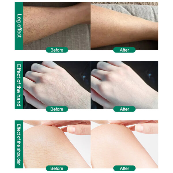 CJEER Upgraded Crystal Hair Removal Magic Crystal Hair Eraser For Women And Men Physical Exfoliating Tool Painless Hair Eraser Removal Tool For Legs Back Arms - Image 17
