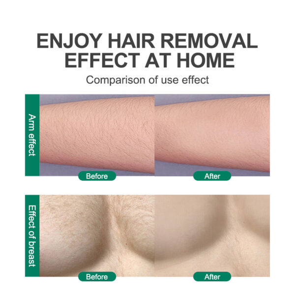 CJEER Upgraded Crystal Hair Removal Magic Crystal Hair Eraser For Women And Men Physical Exfoliating Tool Painless Hair Eraser Removal Tool For Legs Back Arms - Image 14