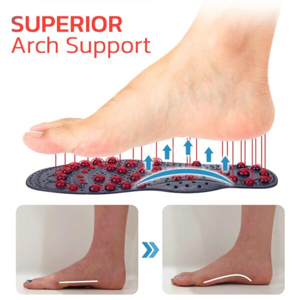 Arch Support, Anti-slip And Wear-resistant Body Care, Slimming And Body Shaping, Vein Repair Insoles - Image 9