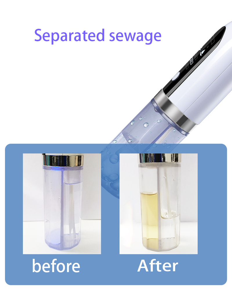 Blackhead Remover Pore Vacuum Cleaner Upgraded Blackhead Vacuum Rechargeable Face Vacuum Comedone Extractor Tool For Blackhead - Image 10
