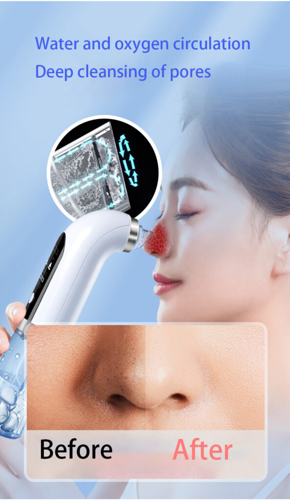 Blackhead Remover Pore Vacuum Cleaner Upgraded Blackhead Vacuum Rechargeable Face Vacuum Comedone Extractor Tool For Blackhead