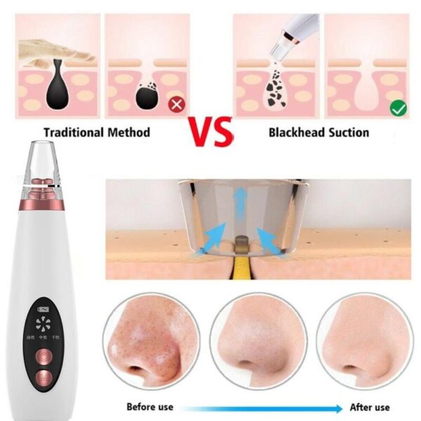 The pores clean artifact household cosmetic instrument suck black new instrument - Image 15