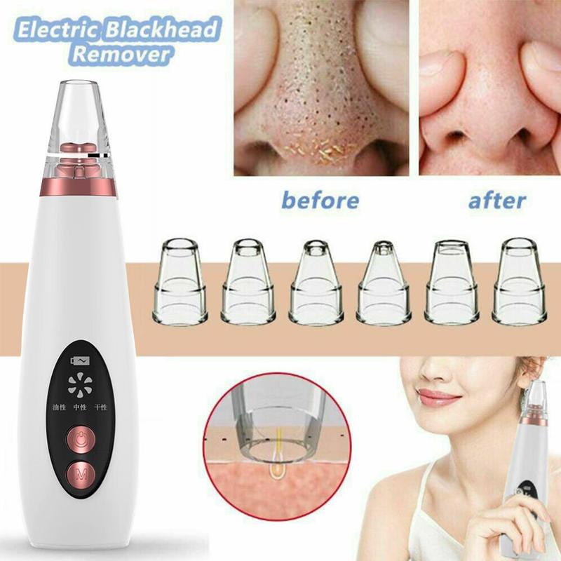 The pores clean artifact household cosmetic instrument suck black new instrument - Image 13