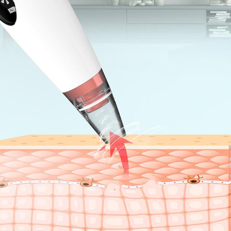 The pores clean artifact household cosmetic instrument suck black new instrument - Image 12