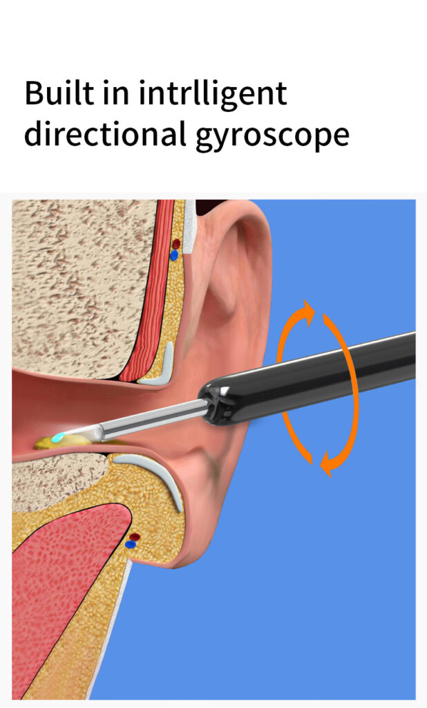 NE3 Ear Cleaner Otoscope Ear Wax Removal Tool With Camera LED Light Wireless Ear Endoscope Ear Cleaning Kit For I-phone