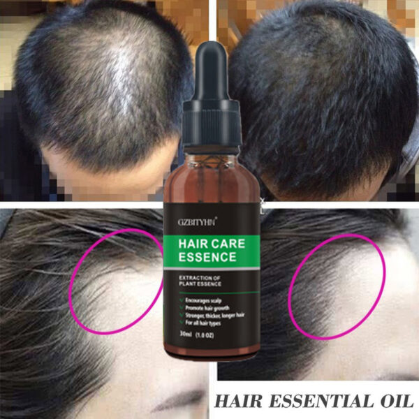 Hair Growth Oil Hair Growth Oil Oem Hair Care Essential Oil - Image 10