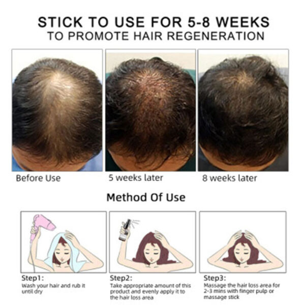 Hair Growth Oil Hair Growth Oil Oem Hair Care Essential Oil - Image 8
