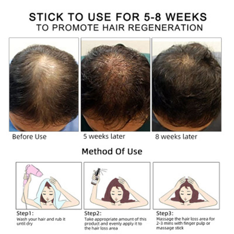 Hair Growth Oil Hair Growth Oil Oem Hair Care Essential Oil - Image 8