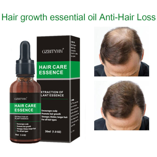 Hair Growth Oil Hair Growth Oil Oem Hair Care Essential Oil - Image 13