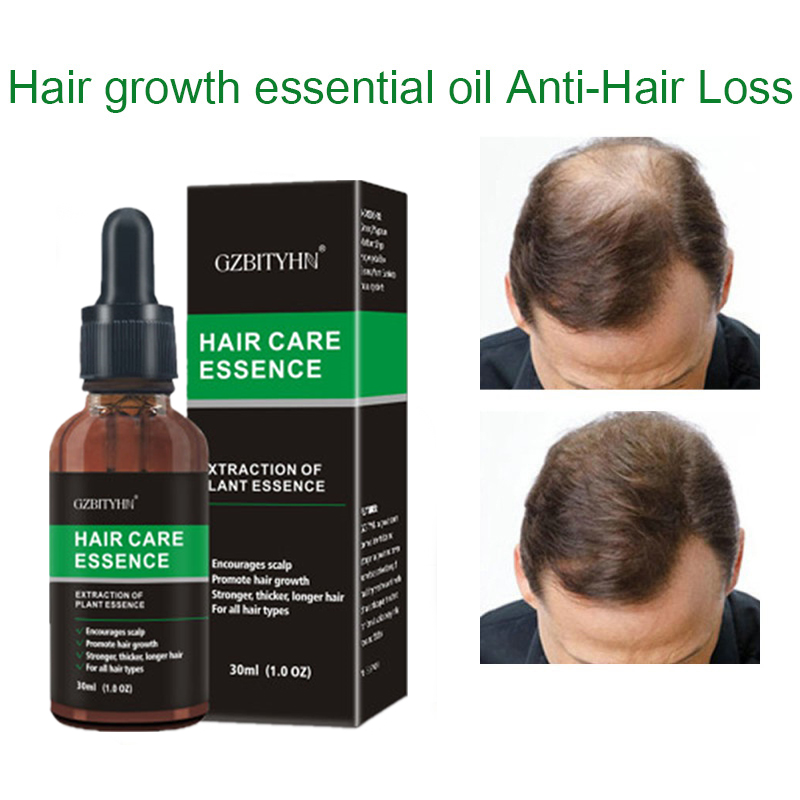 Hair Growth Oil Hair Growth Oil Oem Hair Care Essential Oil - Image 13