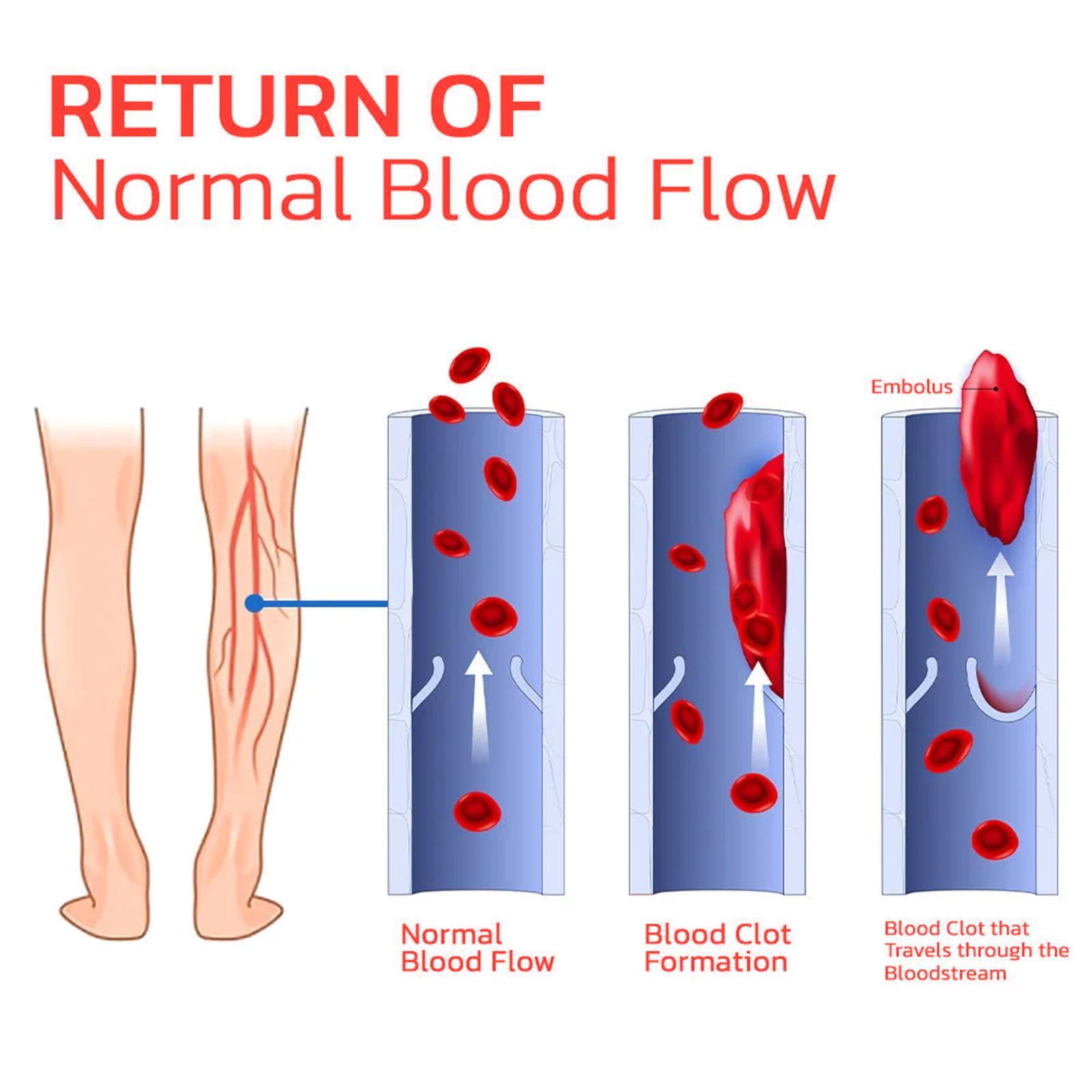 Arch Support, Anti-slip And Wear-resistant Body Care, Slimming And Body Shaping, Vein Repair Insoles - Image 3