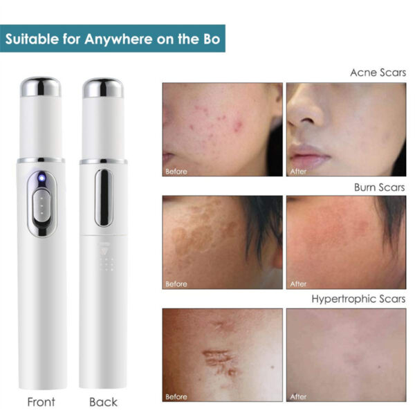 Blue Light Therapy Acne Laser Pen Soft Scar Wrinkle Removal Treatment Device Skin Care Beauty Equipment - Image 13