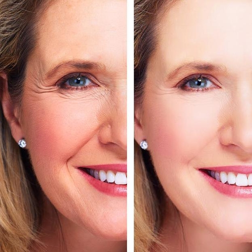 Age Defense : Eye Wrinkle Cream + Vitamin C Serum - Image 4