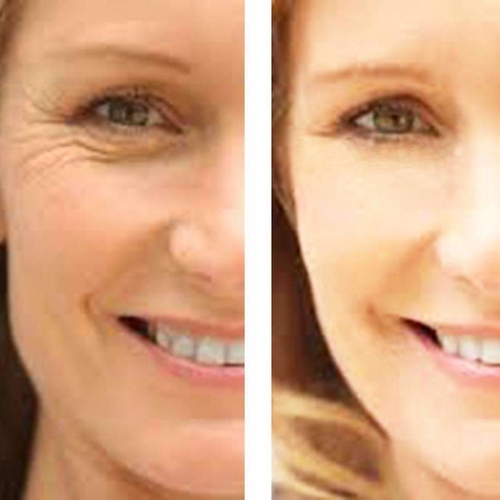 Age Defense : Eye Wrinkle Cream + Vitamin C Serum - Image 6