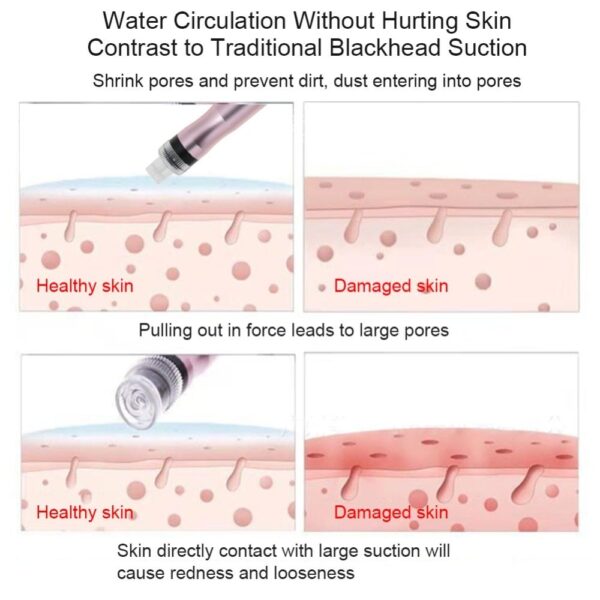Special Offer Portable Oxygen Spray Water Injection Hydro Jet Machine Beauty Blackheads Clean Skin Rejuvenation Oxygen Face Care - Image 8