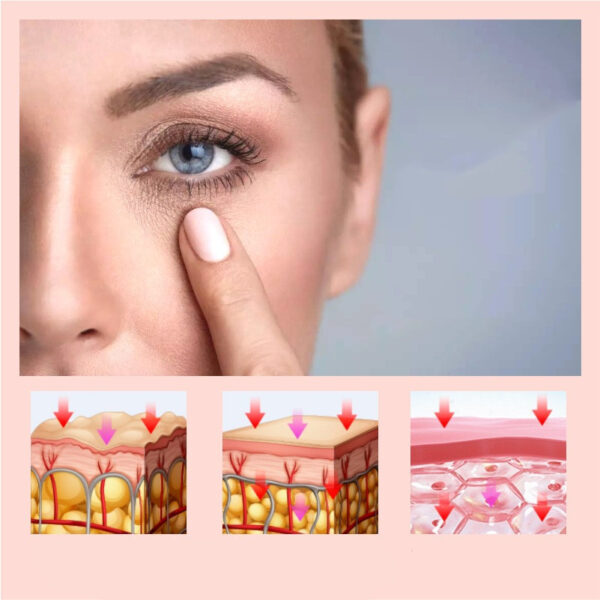 Eye bags beauty equipment - Image 3