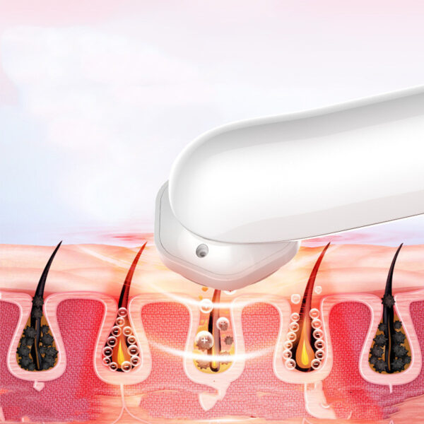 Home Beauty Instrument RF Ion Facial Introduction Instrument - Image 2