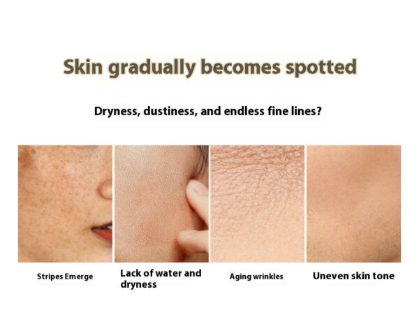 Whitening And Freckle Removing Skin Care Kit Hydrating Moisturizing And Brightening Skin Tone - Image 6