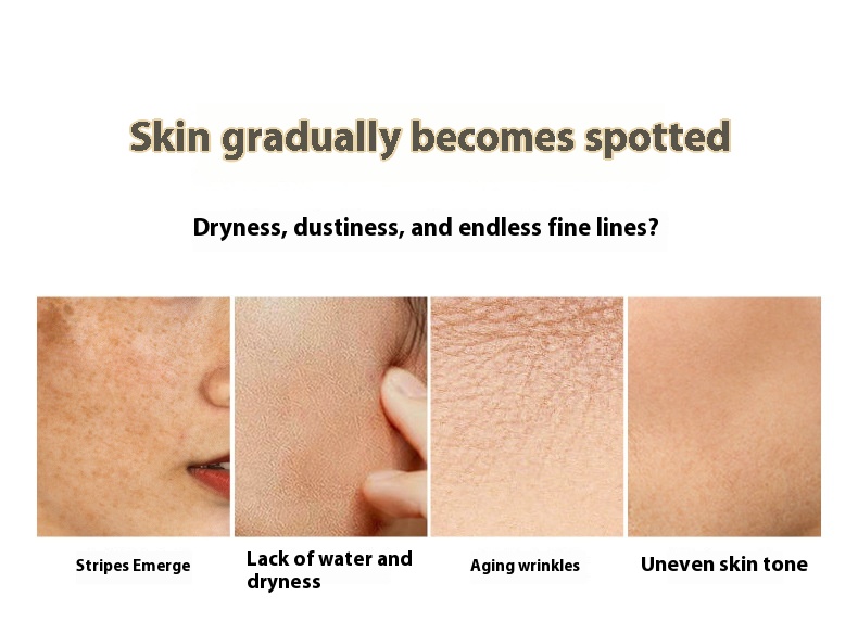Whitening And Freckle Removing Skin Care Kit Hydrating Moisturizing And Brightening Skin Tone - Image 6