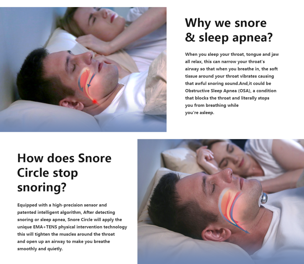 Smart Anti Snoring Device Electronic Muscle Stimulator Pro