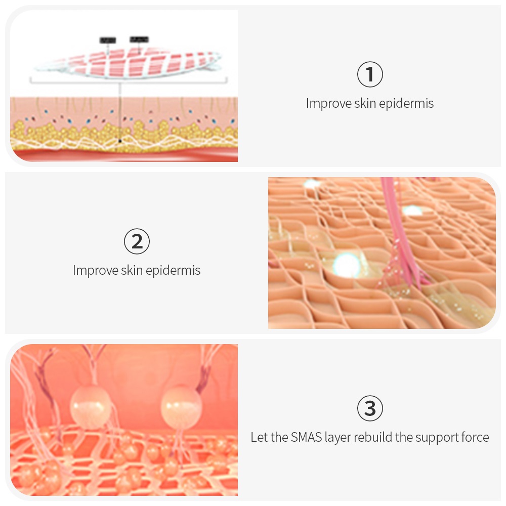 Home V Face Lifting Ultrasonic Knife Lifting Anti-aging Beauty Instrument