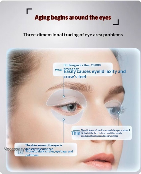 Eye Massager With Heat Therapy For Eye Bags And Dark Circles - Image 4