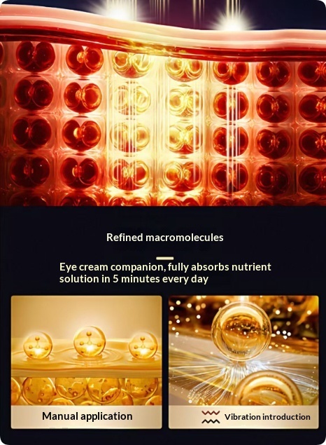 Eye Massager With Heat Therapy For Eye Bags And Dark Circles - Image 3